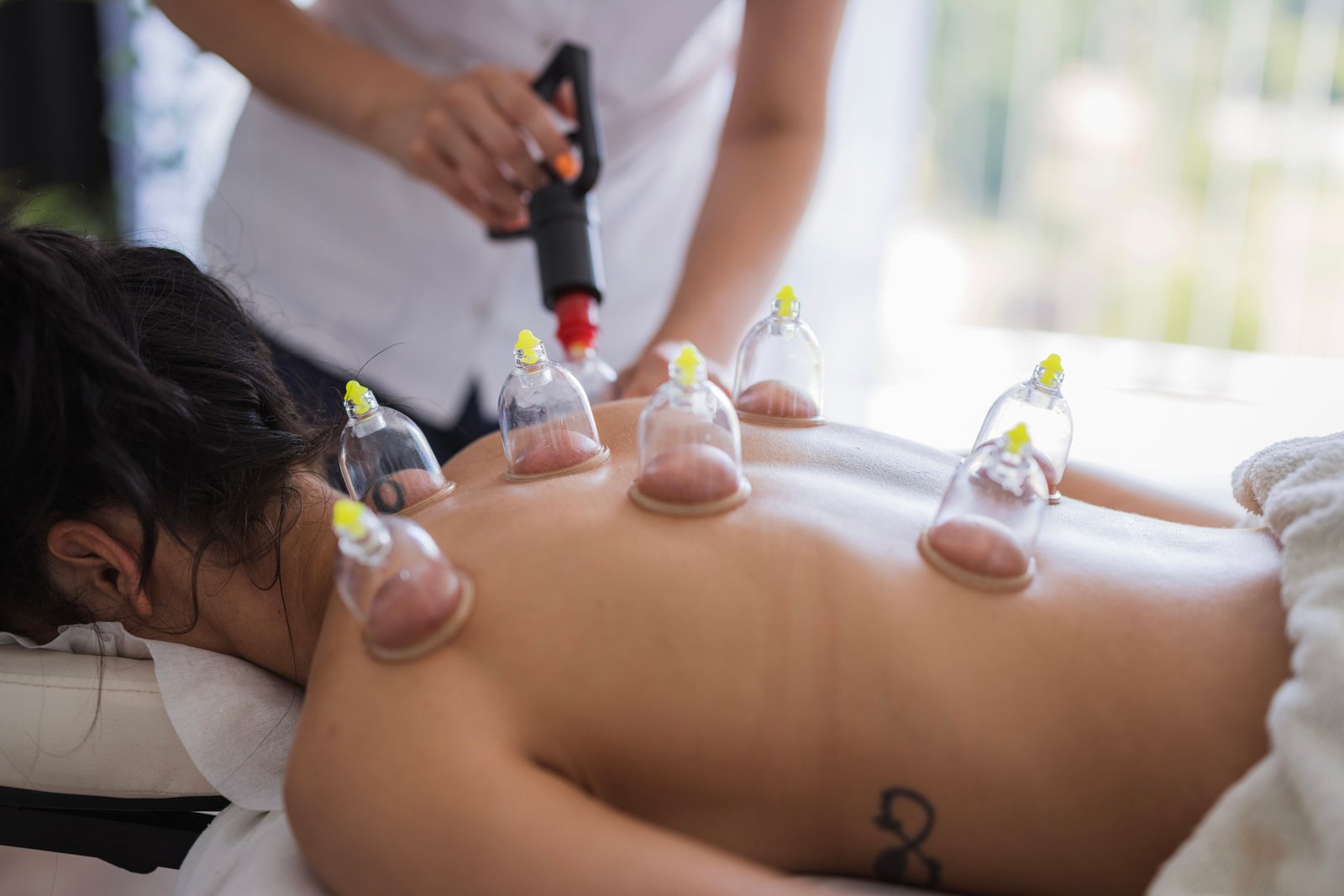 Hajama (Cupping Therapy)